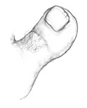 Troll toe